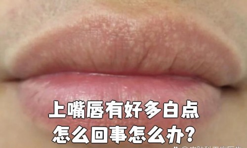 换牙期间用什么牙膏刷牙-换牙期间用什么牙膏网 - 为你提供换牙期间用什么牙膏好、换牙期间用什么样的牙刷比较好